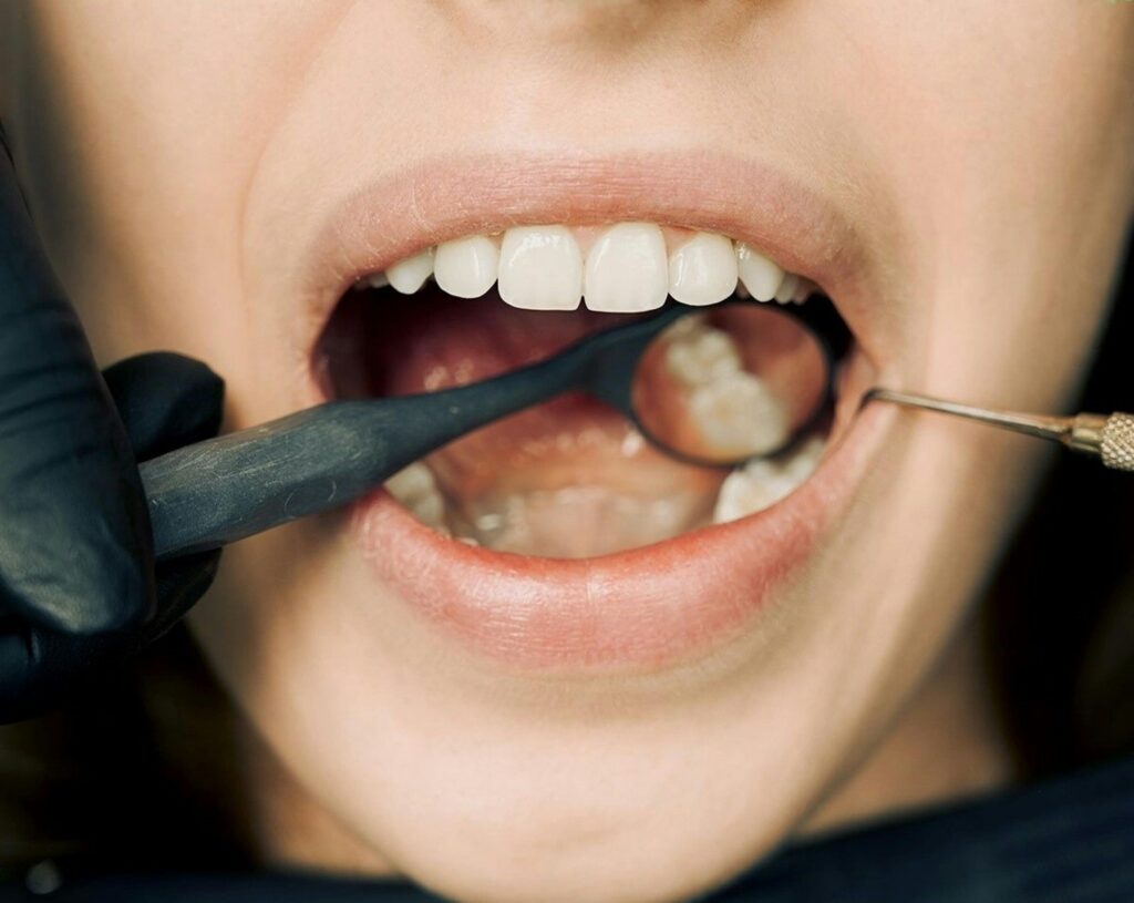 Dentist in Ghana examining a patient’s teeth during a routine dental check-up.